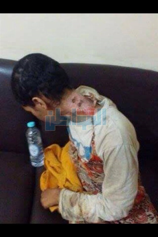 ضبط وإحضار والد الطفلة حياة وزوجتة فى واقعت التعذيب الاسرى بسوهاج