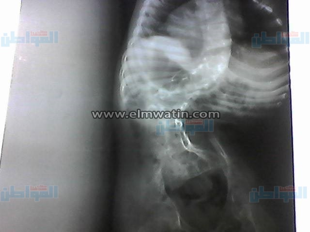 بالصور.. مواطن لوزير الصحة: "مرتبي لا يتجاوز 1000 جنيه وابني بيموت" 