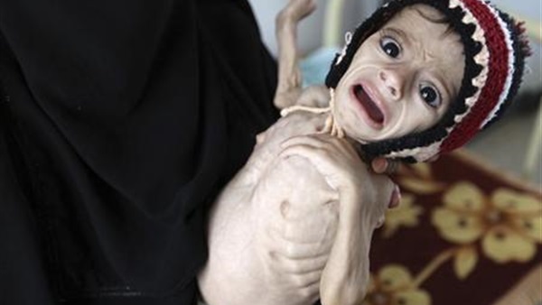 مجاعة اليمن
