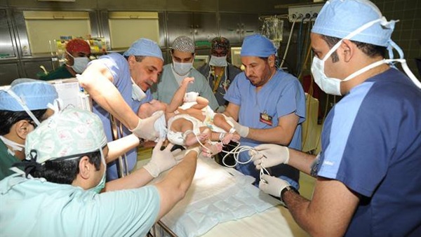 إجراء عملية فصل توأم