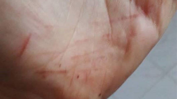التعدي على فتاة في