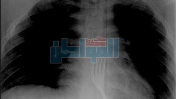 من قلب الحدث