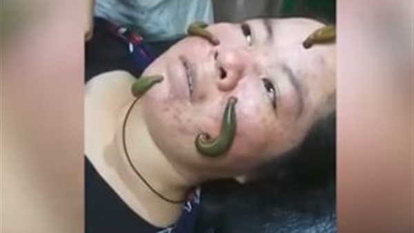 صورة من الفيديو
