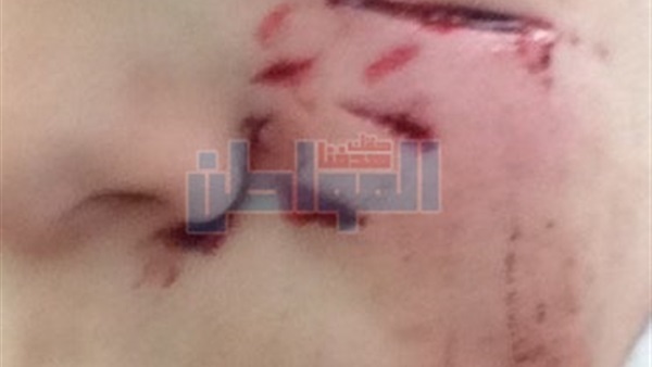 جانب من الحدث