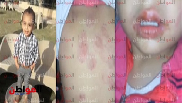 طفل يتعرض للتعذيب