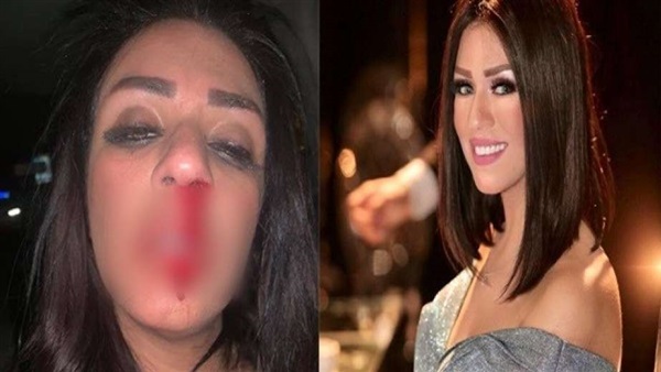 مواجهة ساخنة بين