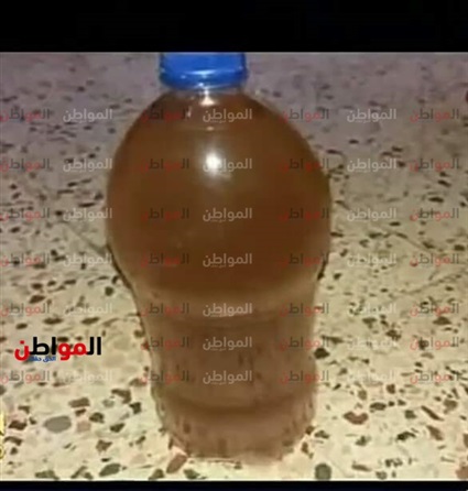 21 ألف نسمة يعانون